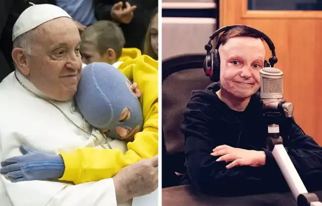 Połowę ciała poparzyła mu rosyjska rakieta. Bez względu na to, co się stanie, nie poddawajcie się Połowę ciała poparzyła mu rosyjska rakieta. Bez względu na to, co się stanie, nie poddawajcie się